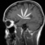 weededbrain-blog-blog