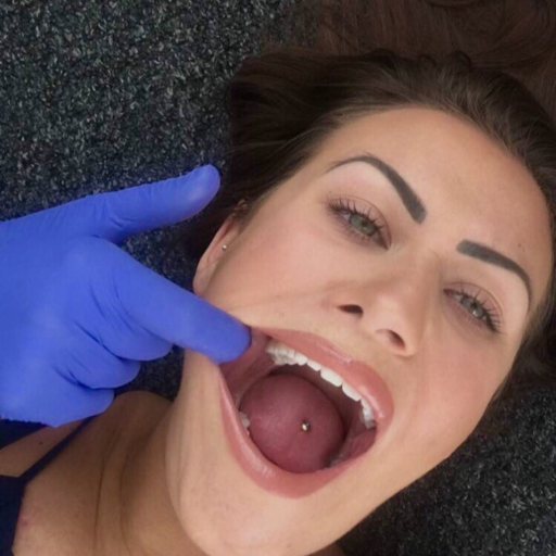 XXX glovedish: dentistfetish85:  ffs it was going photo