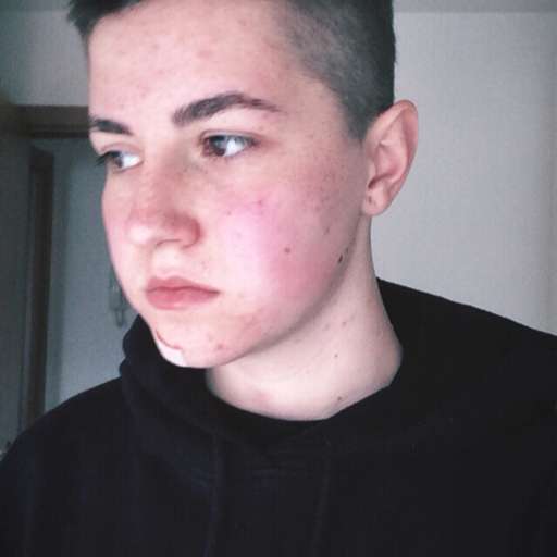 Adam’s looking for transition (ftm)