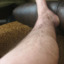 SUPER HAIRY LEGS