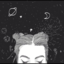 chanelxox9-blog