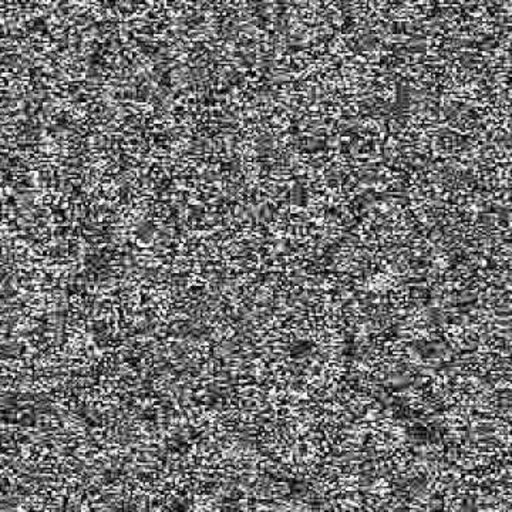 erasedsuggestion:  My mind just isn’t here today