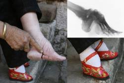 petitegoat: Foot binding became very popular in the 11th century men found it to be highly attractive, and therefore became Chinese women’s way of being beautiful. The foot binding process begins at 4-7 years old soaking her feet in warm water or animal