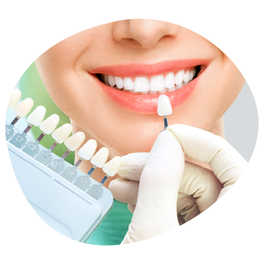 Teeth Whitening Indiranagar | Beyond Smiles Dental Clinic