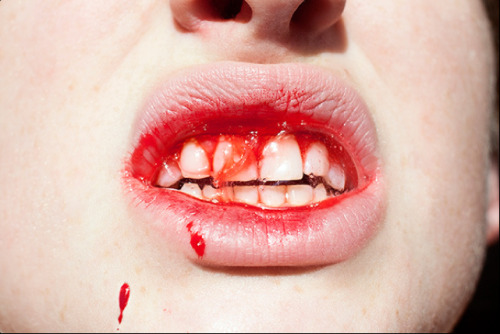 noetich:  Bite Me 