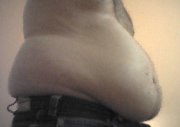 feedmealive:  See what overeating do! Â First picture is an old one and all the