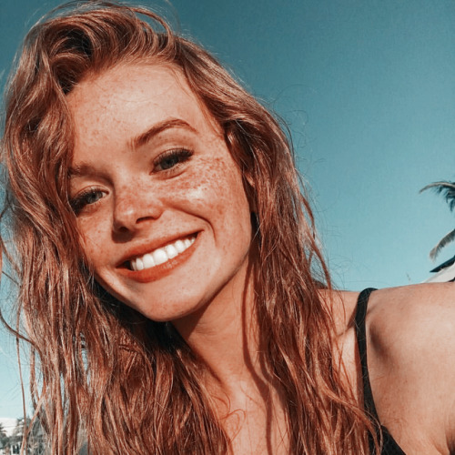 ᴘᴀᴄᴋs：Abbey Cowen ♡ғᴀᴠ/ʀᴇʙʟᴏɢ ₊˚✧