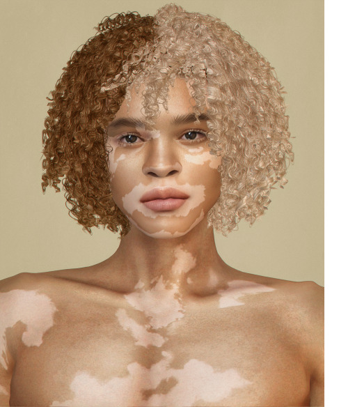 download \ credits: @obscurus-sims​​ & @ddarkstonee​​ ♡ \ info:marcus skin vitiligo - 4 versions