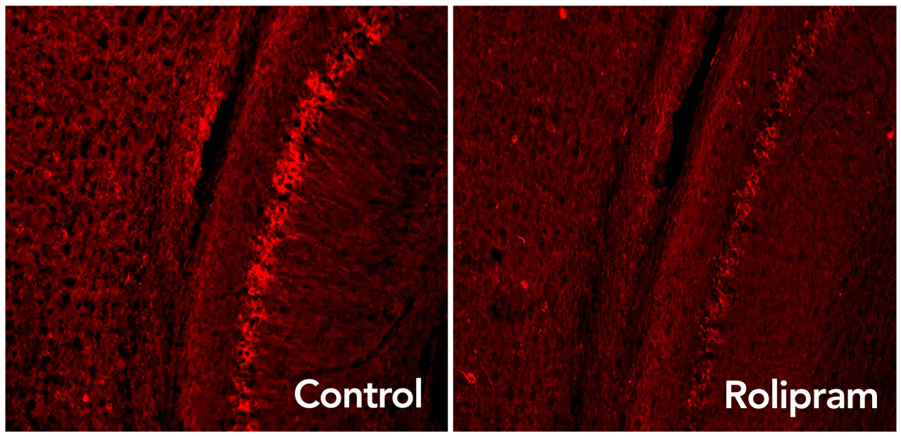 neurosciencestuff:  (Image caption: Rolipram activates the brain’s garbage disposal