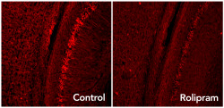 neurosciencestuff:  (Image caption: Rolipram activates the brain’s garbage disposal system, eliminating  excess Tau proteins (glowing red dots) associated with neurodegenerative  diseases such as Alzheimer’s)Improving Brain’s Garbage Disposal May