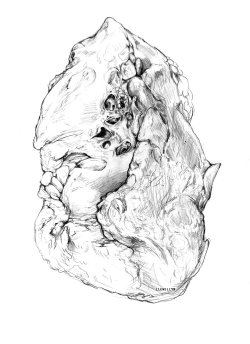 llewellynillustration:  Lungs from cadaver
