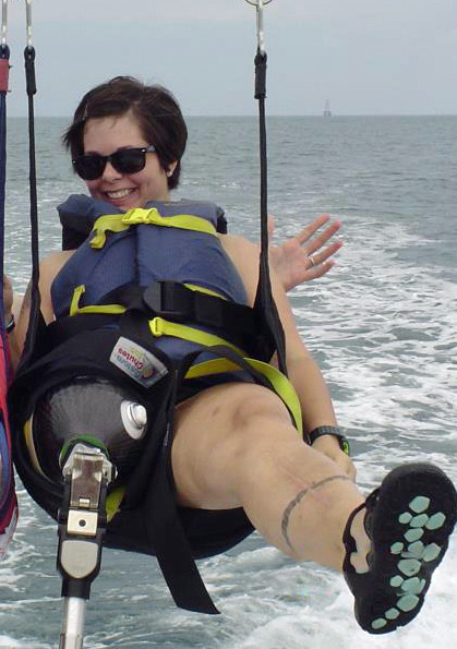 Army captain lost her leg above the knee