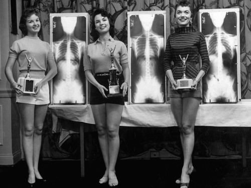 mirlo:mysteryho:historicaltimes:Winners of the “Miss Beautiful Spine” contest. Chicago, 1956 via red