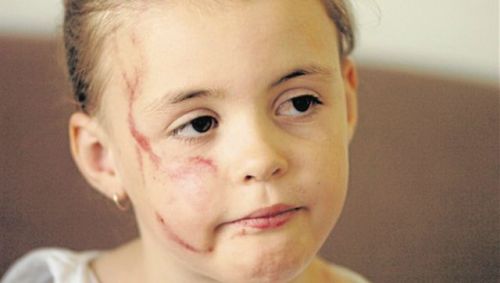 dropmycumberbritches: dropmycumberbritches: Georgian First Grader Beaten and Sexually Assaulted by M