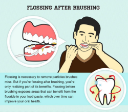 dentagama1:  Do You Floss Before or After