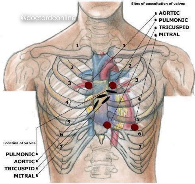 doctordconline:  Location of valves VS Sites of Auscultation of Valves………..