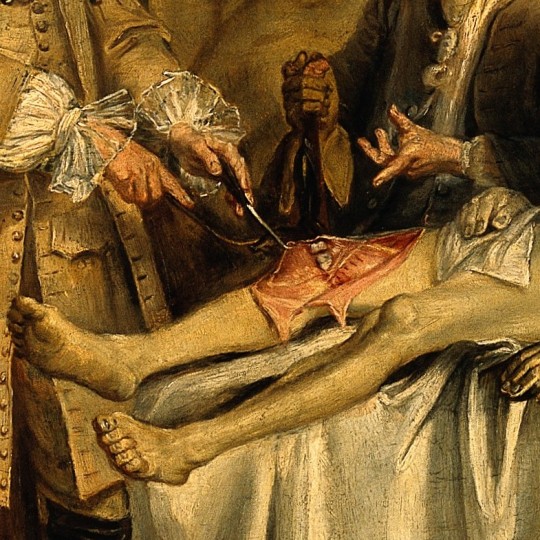 1: The anatomy of Dr Willem Roell after Cornelis Troost, 1728. 2: Anatomy lesson of Dr. Zacheus de Jager by Christiaan...