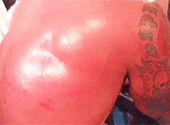 OUCH!