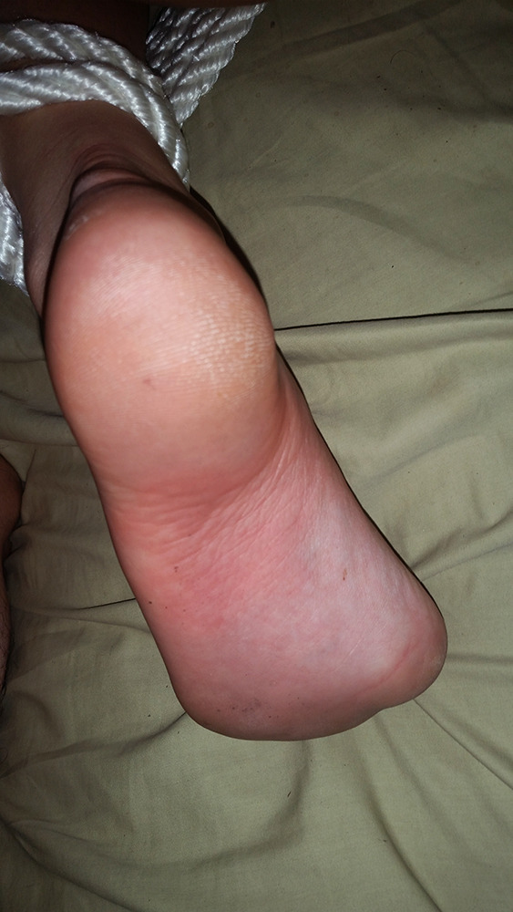 masterra89: Had my slave tied up like a puppy and made her move around on all fours.