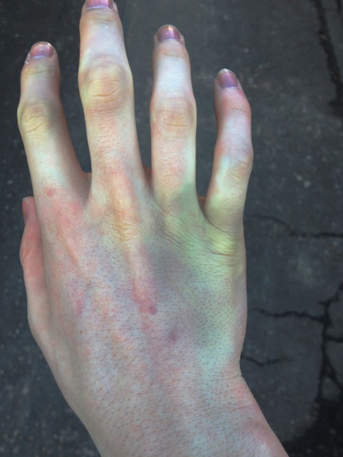 XXX jakeredwolf:  Name of shot: Black Blue World Bruises photo