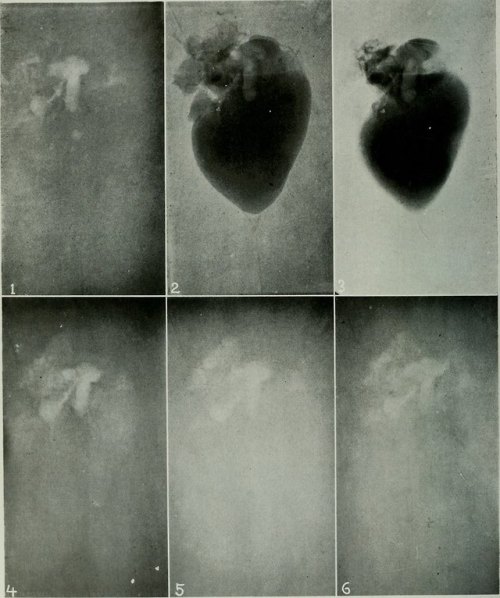 deathandmysticism:The American journal of roentgenology, radium therapy and nuclear medicine, 1906