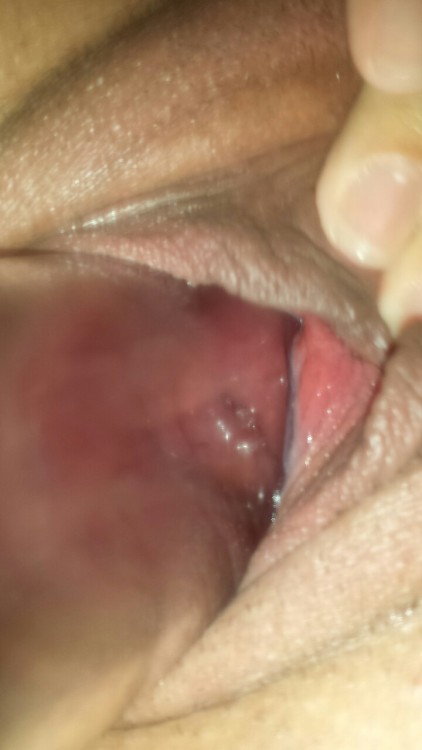 Porn prolapsingpussy:  Penis pump sucking my wife’s photos