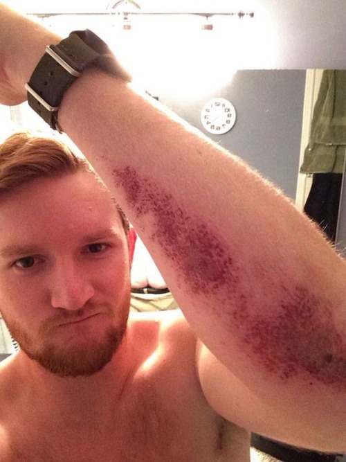 gingers-make-me-hard:  When you see it…