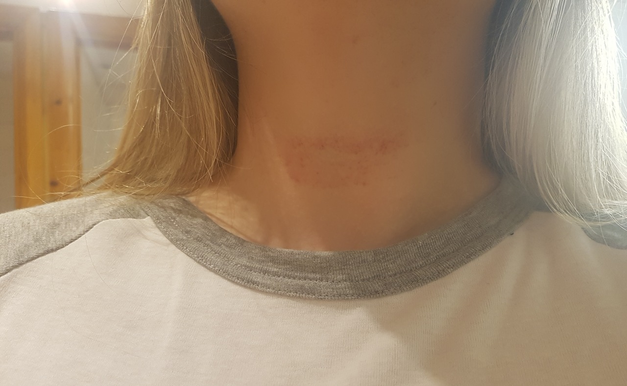 Accidental marks  porn pictures