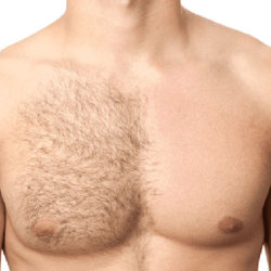 My Chest Hair Blog