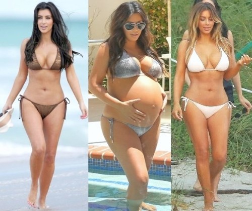 2016 kim kardashian plastic surgery