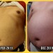 gainerburr:A comparison pic~