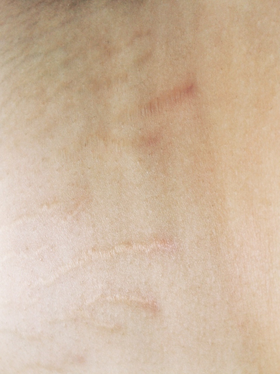 virginsplayground:  These are the parts of myself that I have been taught not to