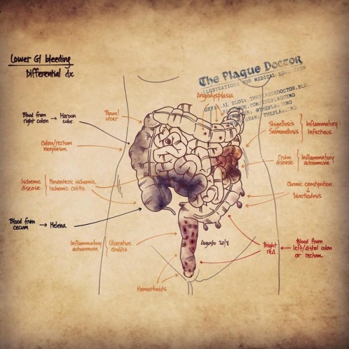 Lower GI bleeding differential diagnosis #gastroenterology #hematology #medicine #postitpearls #doct