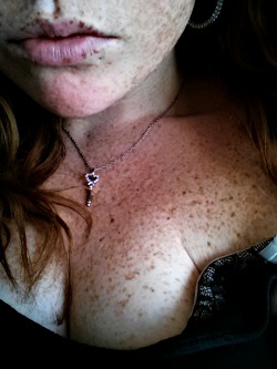 madisonxmonroe:  My freckled lips :) 