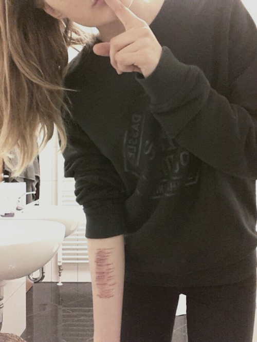 missmieselaune:  Pscht. 