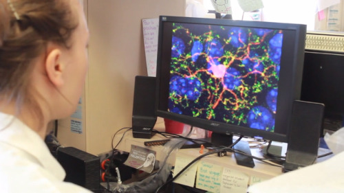 Mechanism that reduces effect of cocaine on brain discoveredA type of brain cell known as microglia 