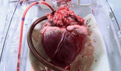 metalhades:  a human hart being keep alive by machines 