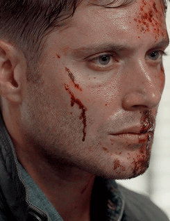 dustydreamsanddirtyscars: #DEAN APPRECIATION WEEKSUNDAY: A Set Dedicated to Dean // Bruised, Bloody and Still Utterly Beautiful