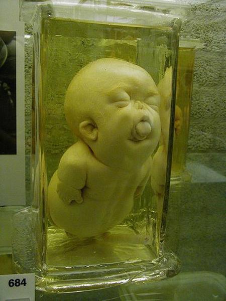 apodemus:  sixpenceee:  If you are into the bizarre and museums like me, than one place you NEED to visit is the Mutter Museum in Pennsylvania.  It’s a medical museum filled with oddities.  Some things it has are the body of the soap lady (1st picture).