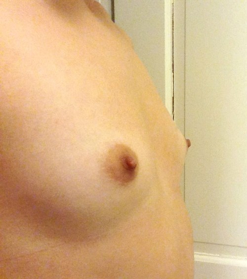 ourbreasts:Submission: Hi, I am 20 and am very insecure about my breasts. I have always disliked their small size (34A/AA USA), asymmetry, and pointedness. I still to this day have never let any of my boyfriends see them completely, without me trying