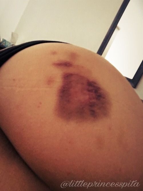 littleprincesspita: dshreda: littleprincesspita: …beaten, bruised and high on happiness&helli