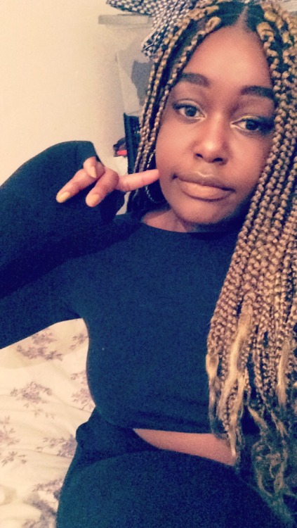pdfprincess:  First time going blond and trying to regain a pain free scalp 😊😭✨
