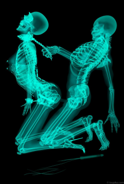 vaultofbondage:  X-ray-ted sex picture