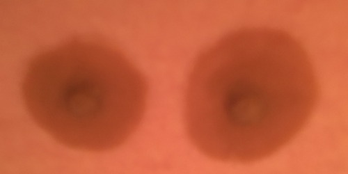 ftmproductreviews:GenderMender ftm prosthetic nipples!Hey guys today I’m going to tell you about a c