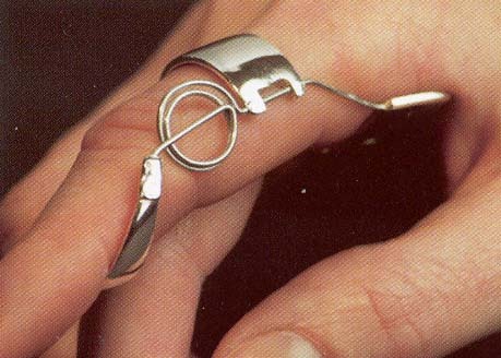 jesoa:  silver ring splints