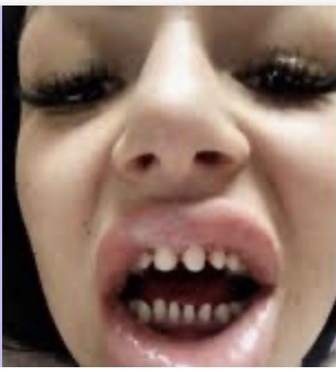 God These Dumb Motherfuckers Really Trying To One Up My Boi With This Stupid Ass Worthless Trend