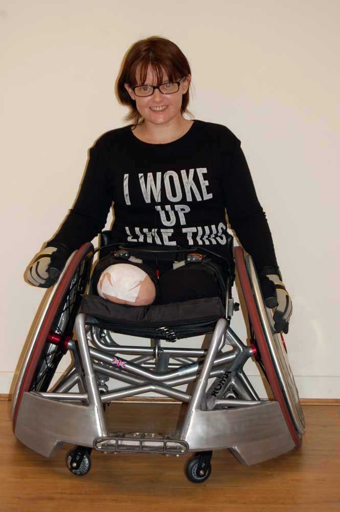 Phelddagrif Lost Her Legs Due To Infection And Crps Tumblr Pics