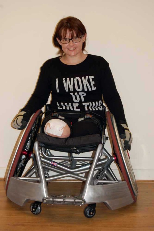 Lost her legs due to infection and CRPS