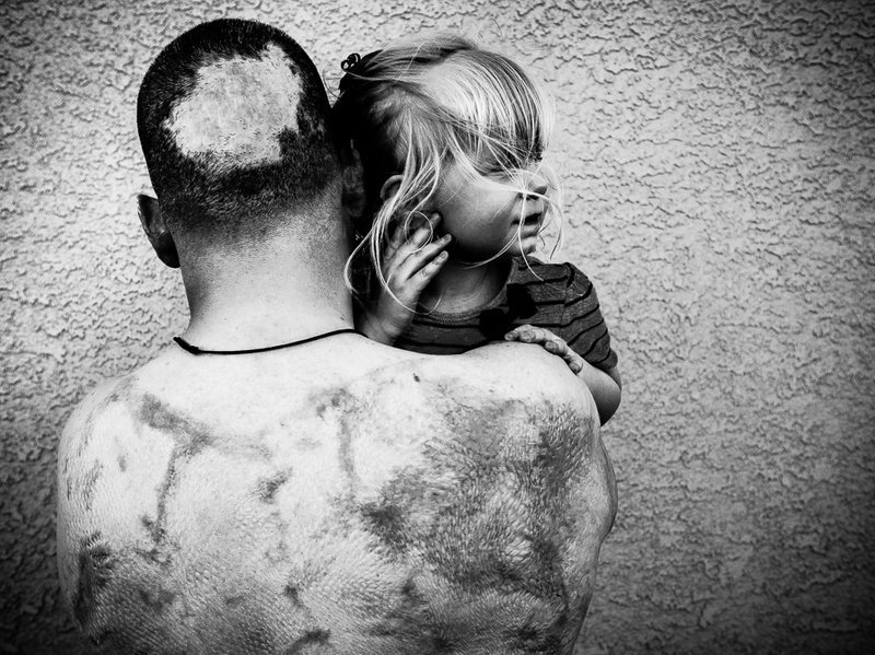 npr:  It’s impolite to stare. But when it comes to severely injured soldiers, maybe