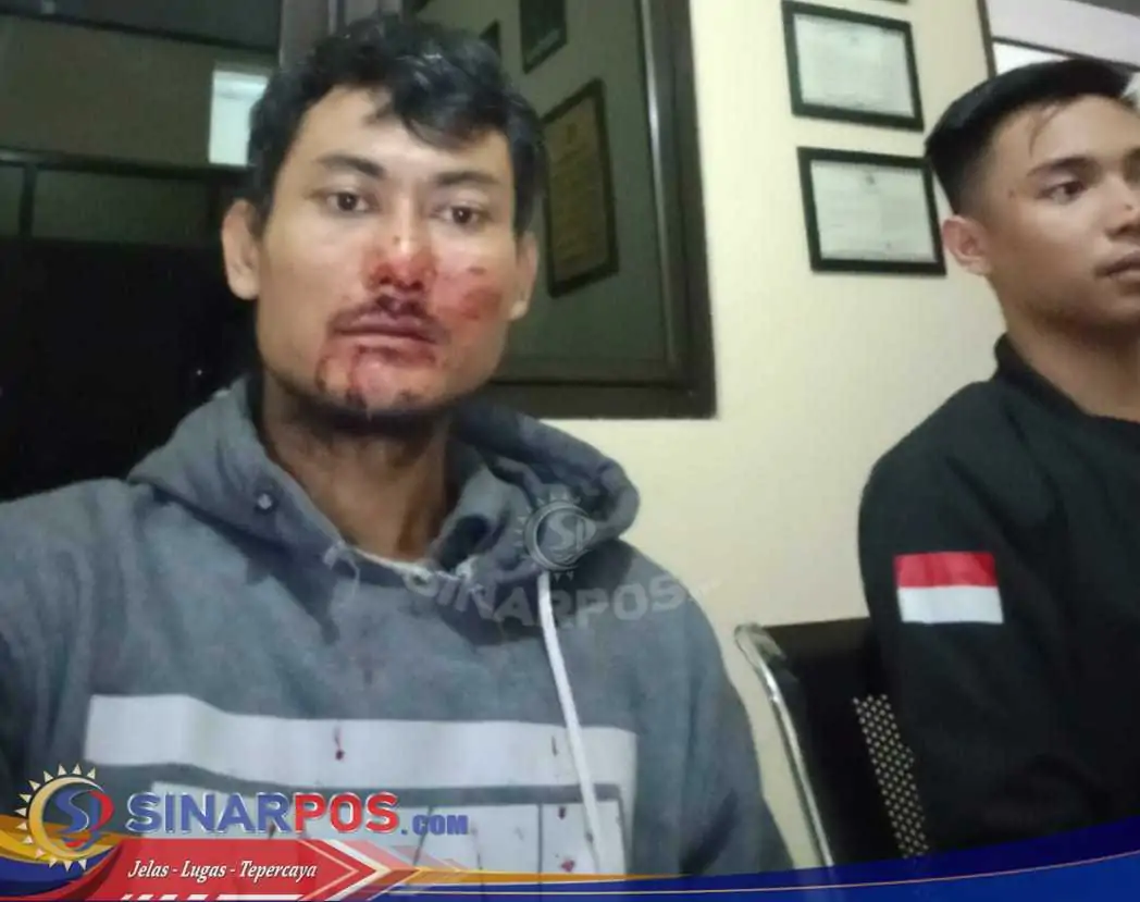 2 Orang Pengurus FWJ Indonesia Korwil Kuningan Dikeroyok 15 Orang Ngaku Ormas Al Jabar